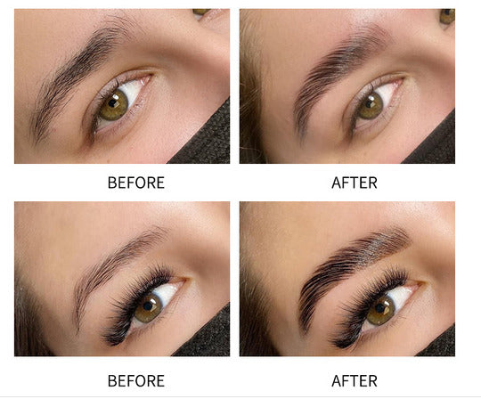 Iconsign Eyebrow Lifting Kit